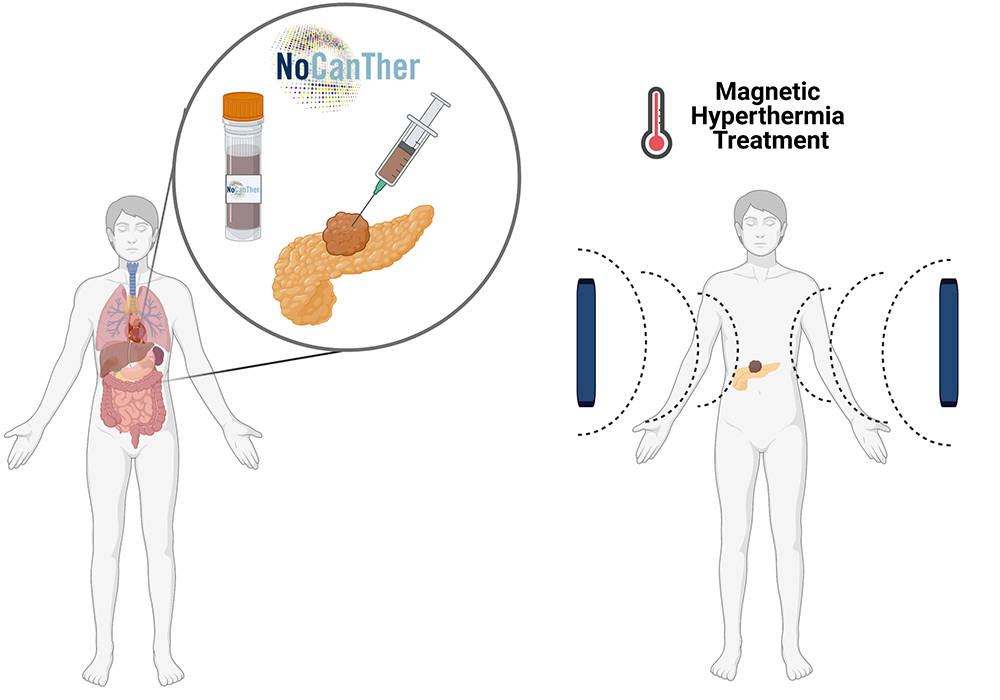 np nocanther clinical study